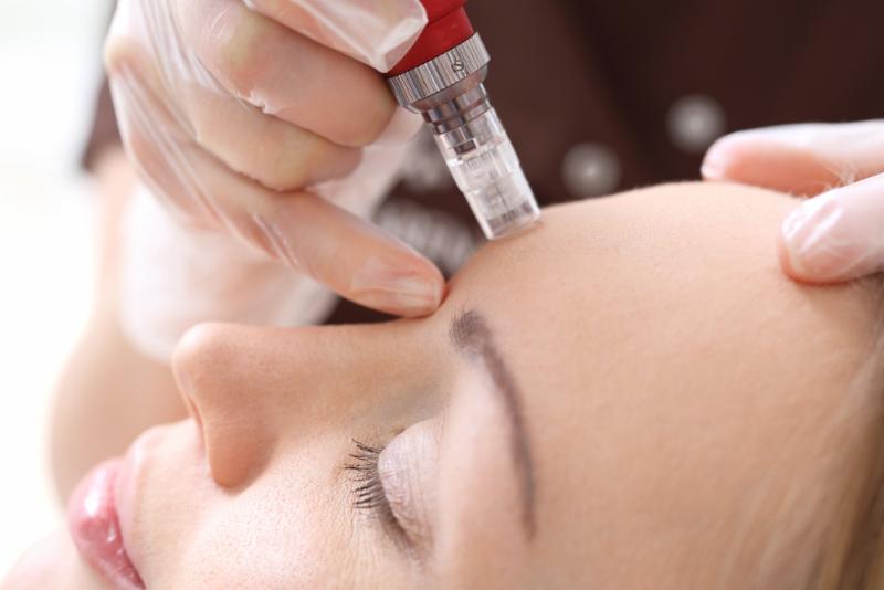 Anti Aging Microneedling