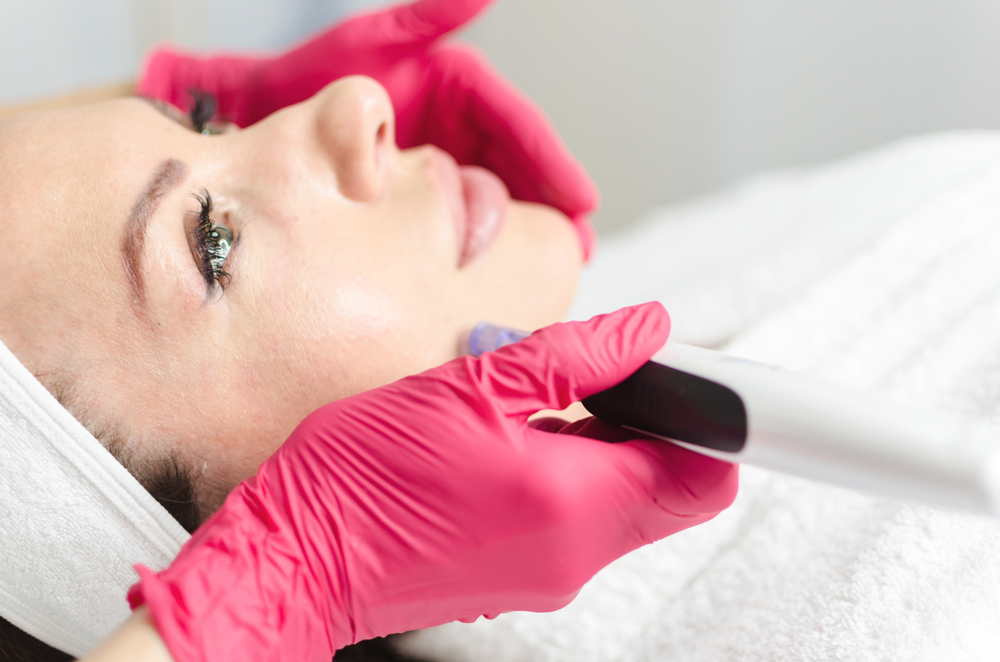 Microneedling and Platelet Rich Plasma