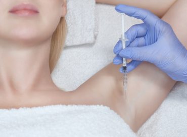  What It’s Like to Get Botox for Sweating
