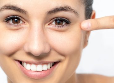 Botox for Crow's Feet - How Long Does It Last?