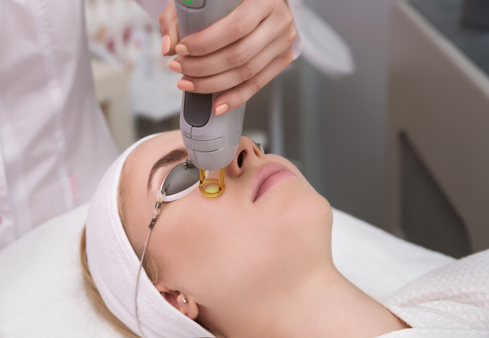 Laser Facial in Hagerstown