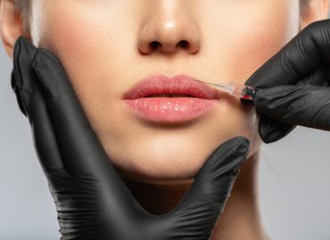 Botox Lip Flip Near Me [Hagerstown, MD]