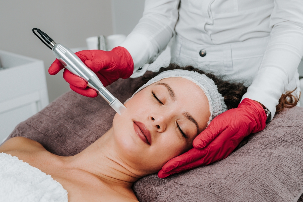 Microneedling With PRP: Top Facts You Should Know