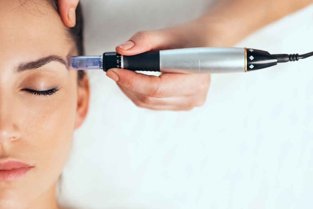 How Long Does PRP Microneedling Really Last?