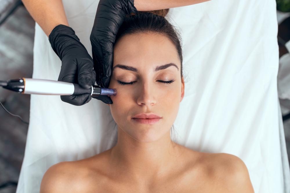 How Does Microneedling Work with PRP?