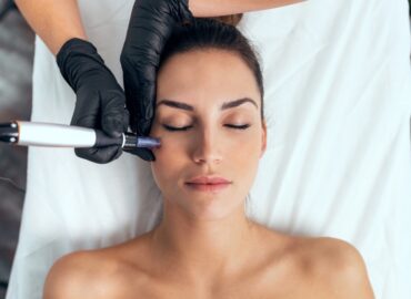 How Much Is Microneedling With PRP?