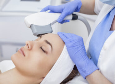 Best IPL Treatments in Frederick: Answers to FAQs