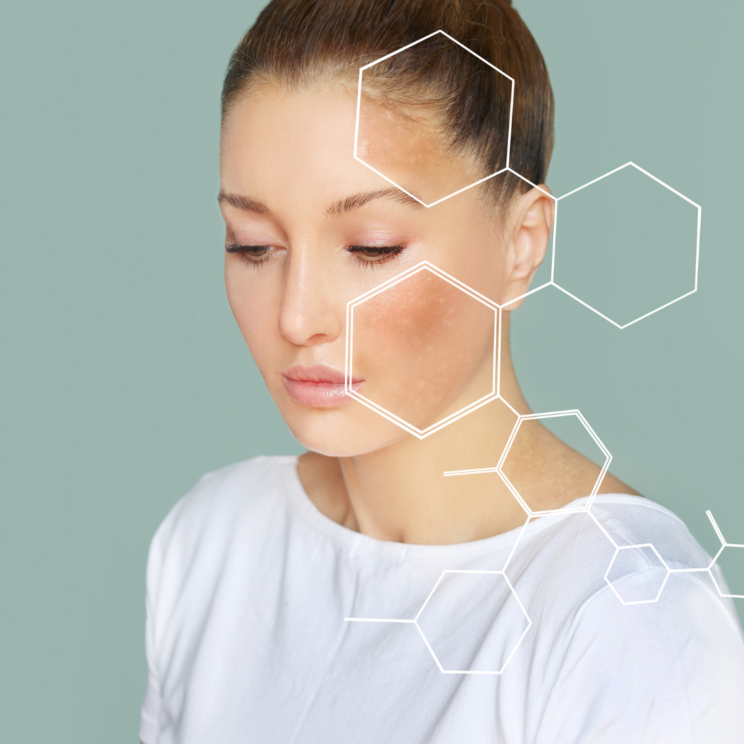 Dark Spot Reduction Treatment Options
