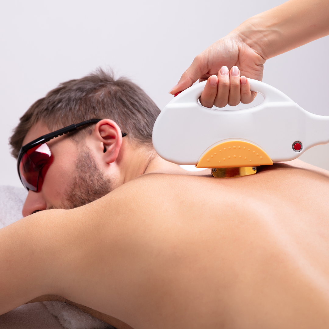 Best Devices for the #1 Laser Hair Removal in Winchester, Virginia