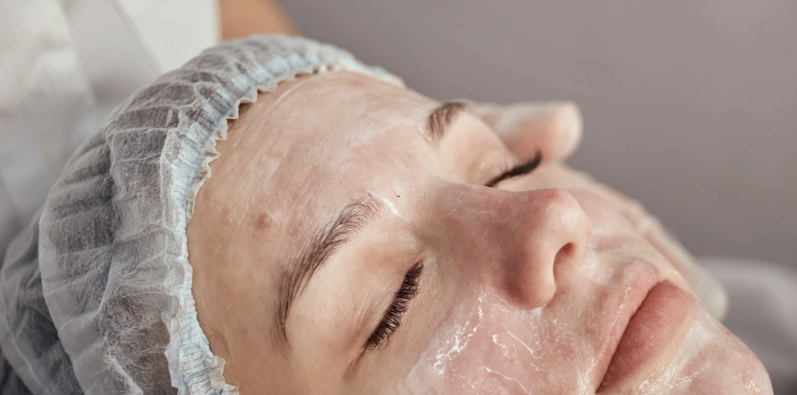 Hormonal Acne Solutions Near Martinsburg WV