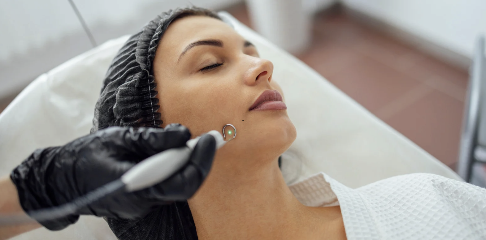 Same-Day Acne Clinic Near Frederick MD